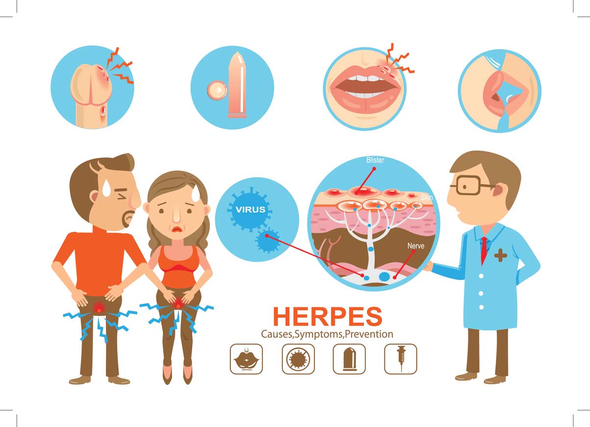 herpes.jpg